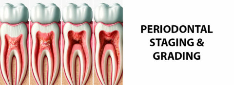 The Periodontal Staging and Grading Guide and the Symptoms