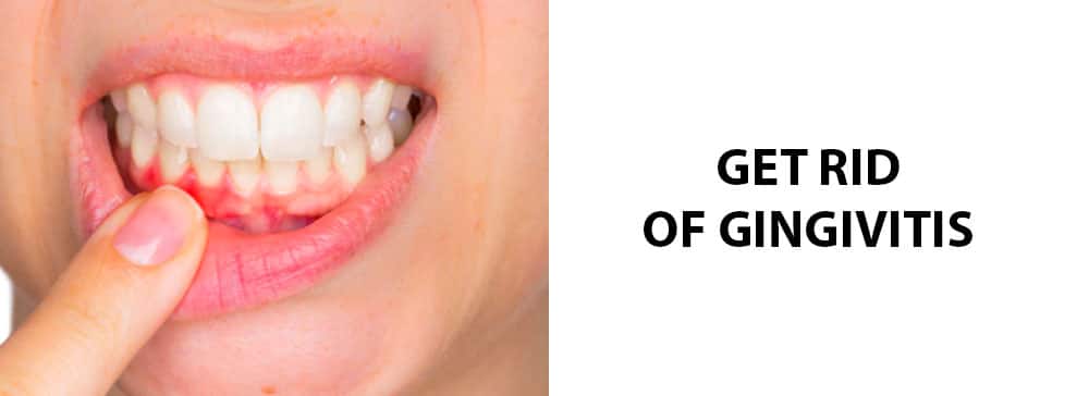 How Do I Get Rid Of Gingivitis? Treatments & Symptoms